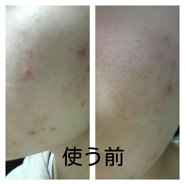 20180330123542194.jpg