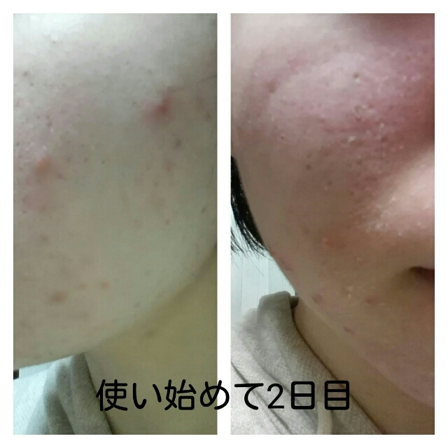 20180330125327457.jpg