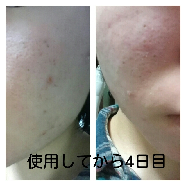 20180330130002906.jpg